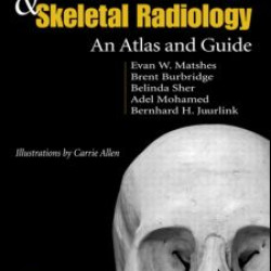 Human Osteology and Skeletal Radiology