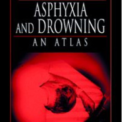 Asphyxia and Drowning Asphyxia and Drowning