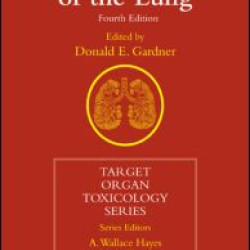 Toxicology of the Lung