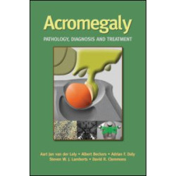 Acromegaly Acromegaly