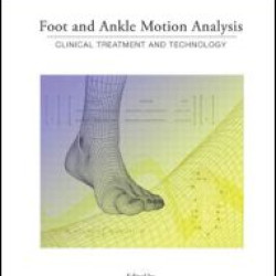 Foot and Ankle Motion Analysis Foot and Ankle Motion Analysis