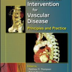 Endovascular Intervention for Vascular Disease