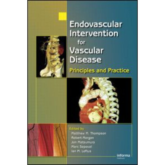 Endovascular Intervention for Vascular Disease