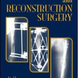 Limb Lengthening and Reconstruction Surgery Limb Lengthening and Reconstruction Surgery
