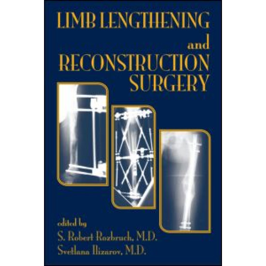 Limb Lengthening and Reconstruction Surgery Limb Lengthening and Reconstruction Surgery