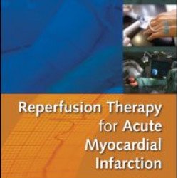 Reperfusion Therapy for Acute Myocardial Infarction Reperfusion Therapy for Acute Myocardial Infarction