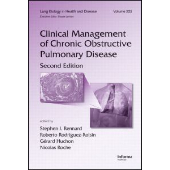 Clinical Management of Chronic Obstructive Pulmonary Disease Clinical Management of Chronic Obstructive Pulmonary Disease