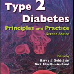 Type 2 Diabetes Type 2 Diabetes