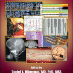 Neuroengineering Neuroengineering