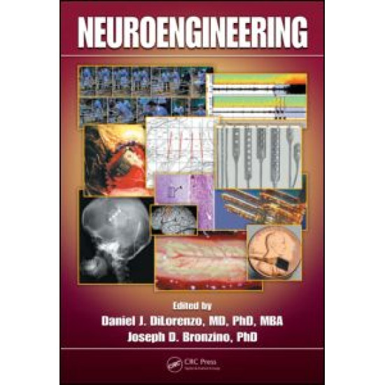 Neuroengineering Neuroengineering