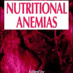 Nutritional Anemias Nutritional Anemias
