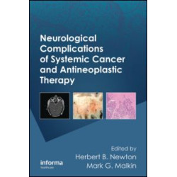 Neurological Complications of Systemic Cancer and Antineoplastic Therapy Neurological Complications of Systemic Cancer and Antineoplastic Therapy