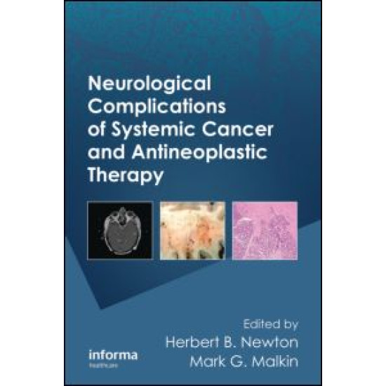 Neurological Complications of Systemic Cancer and Antineoplastic Therapy