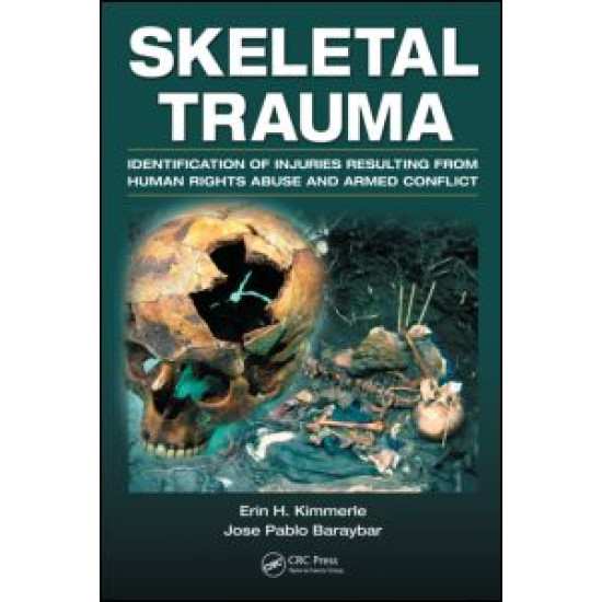 Skeletal Trauma Skeletal Trauma