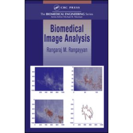 Biomedical Image Analysis Biomedical Image Analysis