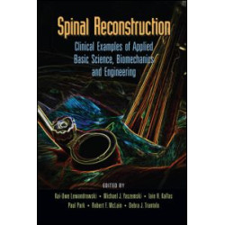 Spinal Reconstruction