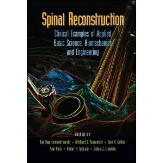 Spinal Reconstruction Spinal Reconstruction