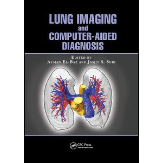 Lung Imaging and Computer Aided Diagnosis