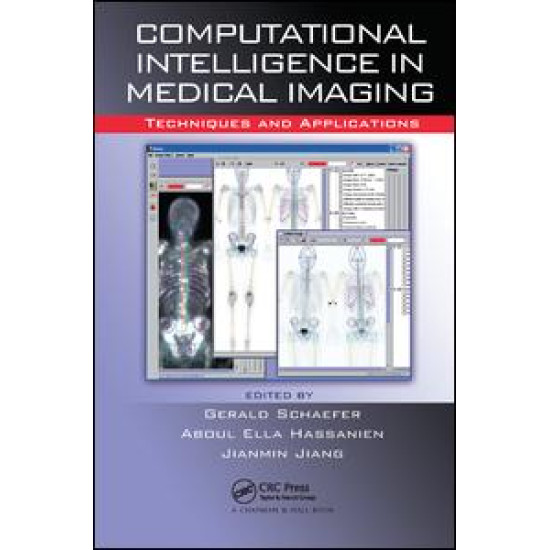 Computational Intelligence in Medical Imaging