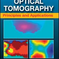 Diffuse Optical Tomography Diffuse Optical Tomography