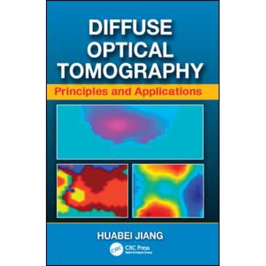 Diffuse Optical Tomography Diffuse Optical Tomography