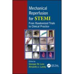 Mechanical Reperfusion for STEMI Mechanical Reperfusion for STEMI