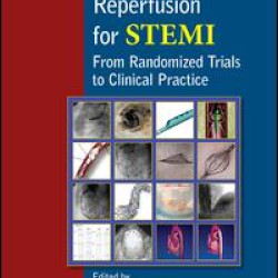 Mechanical Reperfusion for STEMI Mechanical Reperfusion for STEMI