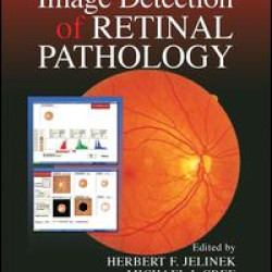 Automated Image Detection of Retinal Pathology