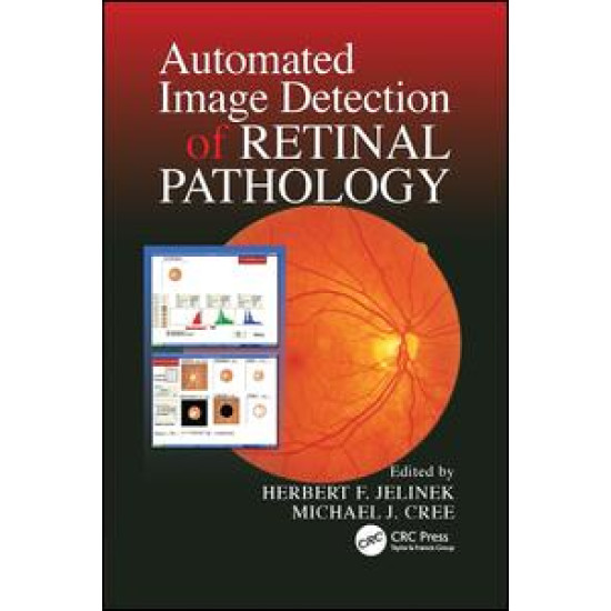 Automated Image Detection of Retinal Pathology