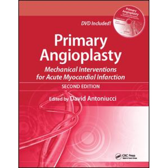 Primary Angioplasty Primary Angioplasty
