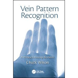 Vein Pattern Recognition Vein Pattern Recognition