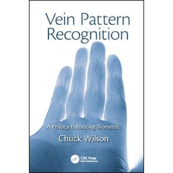 Vein Pattern Recognition