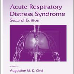 Acute Respiratory Distress Syndrome Acute Respiratory Distress Syndrome