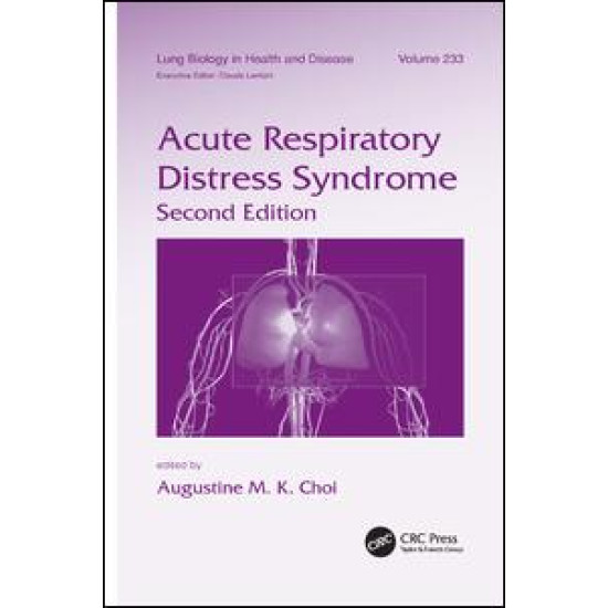 Acute Respiratory Distress Syndrome Acute Respiratory Distress Syndrome
