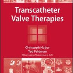 Transcatheter Valve Therapies Transcatheter Valve Therapies