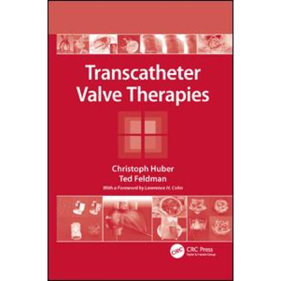 Transcatheter Valve Therapies Transcatheter Valve Therapies