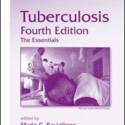 Tuberculosis Tuberculosis