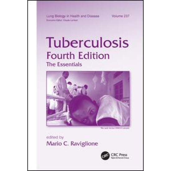 Tuberculosis Tuberculosis