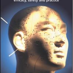 Acupuncture Acupuncture