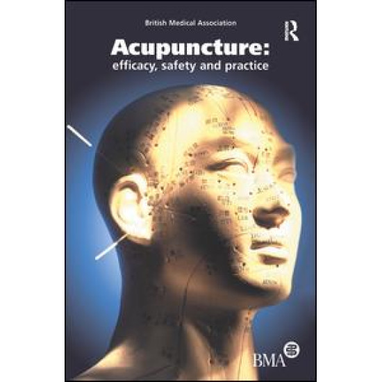 Acupuncture Acupuncture