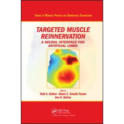 Targeted Muscle Reinnervation Targeted Muscle Reinnervation