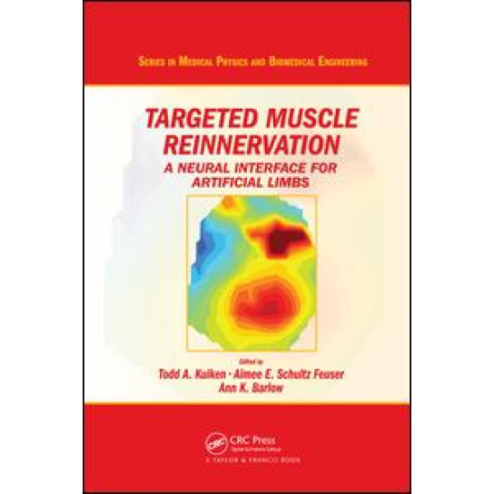 Targeted Muscle Reinnervation Targeted Muscle Reinnervation