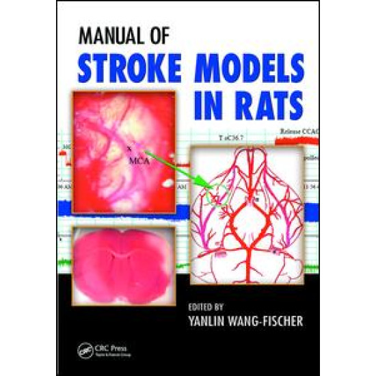 Manual of Stroke Models in Rats