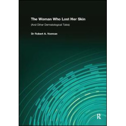 The Woman Who Lost Her Skin