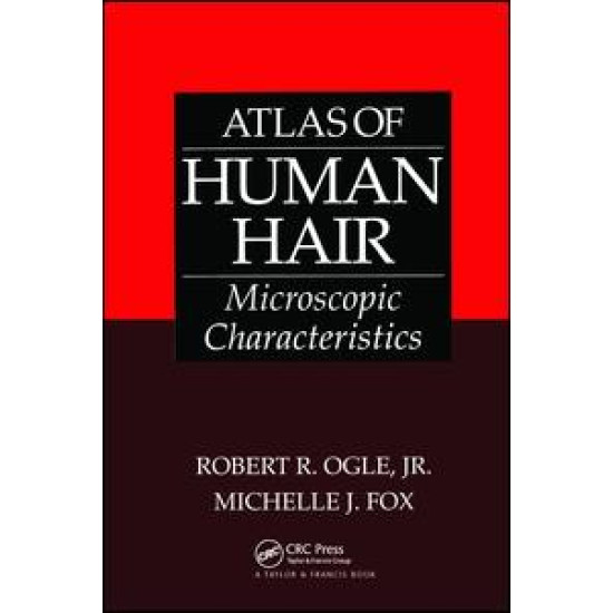Atlas of Human Hair Atlas of Human Hair
