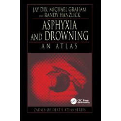 Asphyxia and Drowning Asphyxia and Drowning
