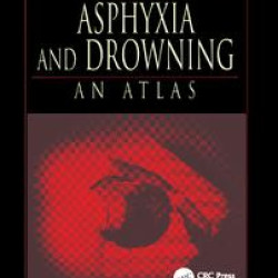 Asphyxia and Drowning Asphyxia and Drowning