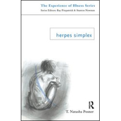 Herpes Simplex Herpes Simplex