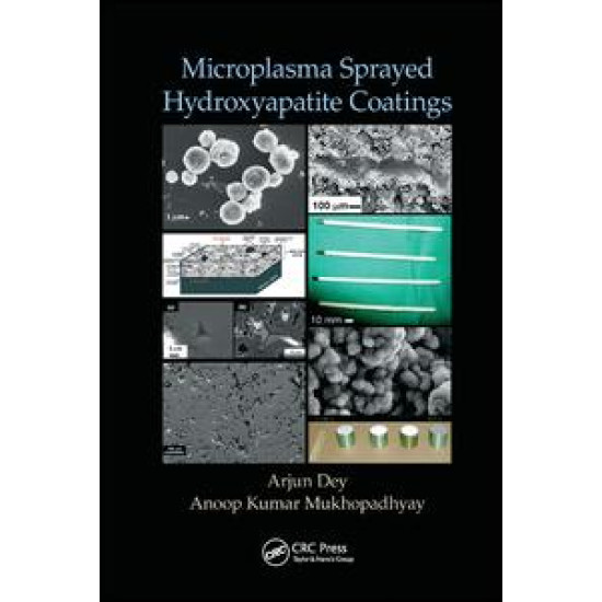 Microplasma Sprayed Hydroxyapatite Coatings Microplasma Sprayed Hydroxyapatite Coatings