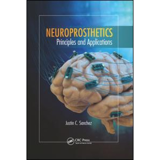 Neuroprosthetics